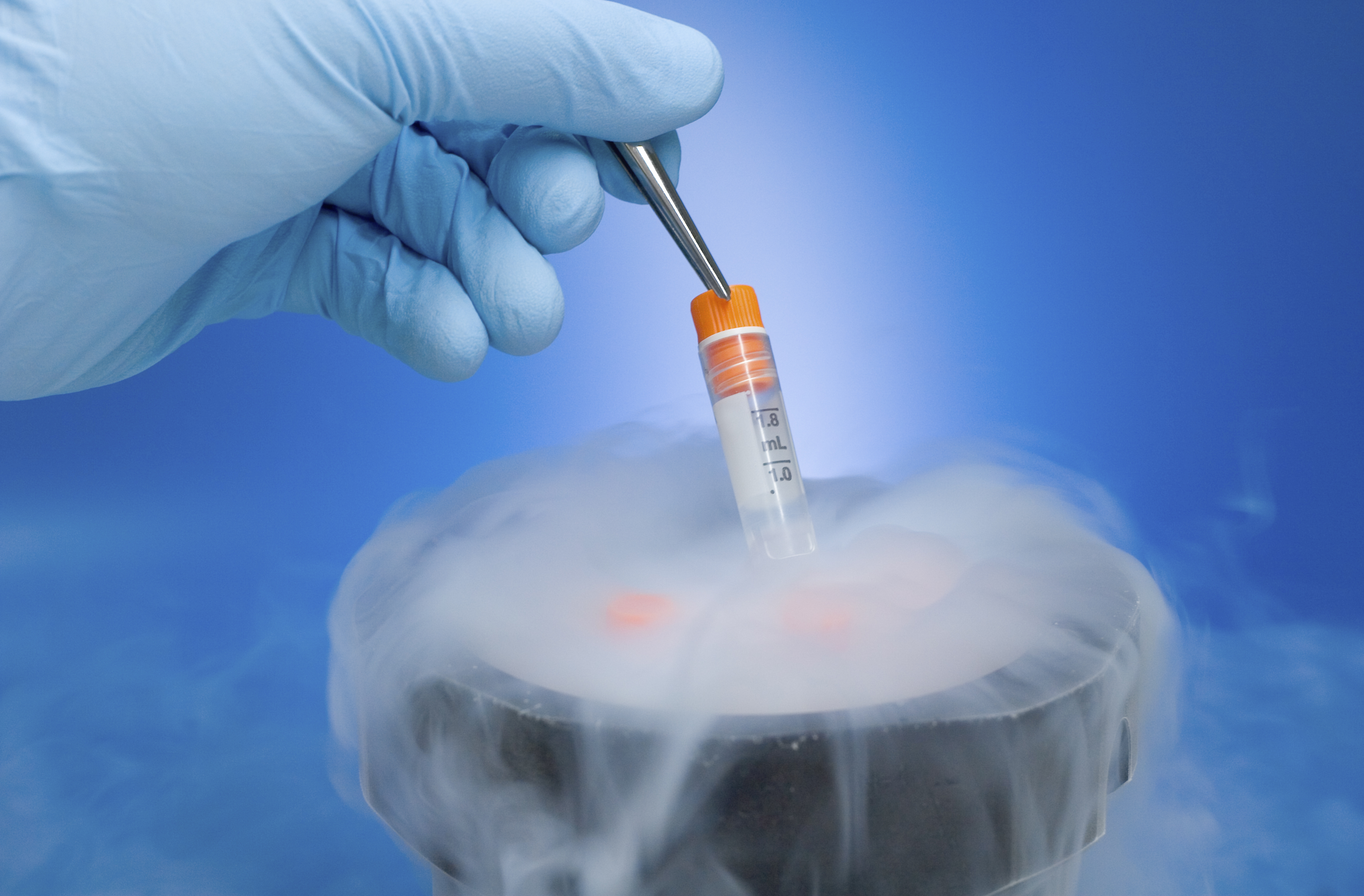 How Long Can Sperm Stay Frozen? What the Research Says