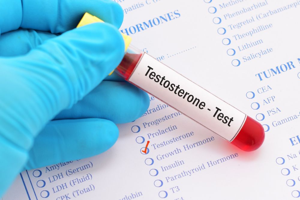 What is Male Hormone Replacement Therapy?